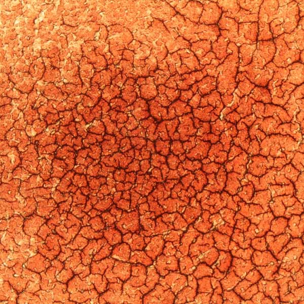 Dry blood sample showing oxygen levels after a session of PEMF therapy on CELLER8
