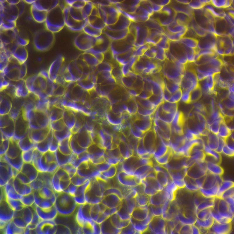 Red blood cells before a session of PEMF therapy on CELLER8